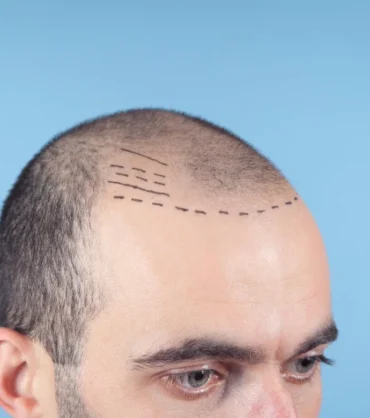 1744633267_b1577e1e62e8e65ccef0