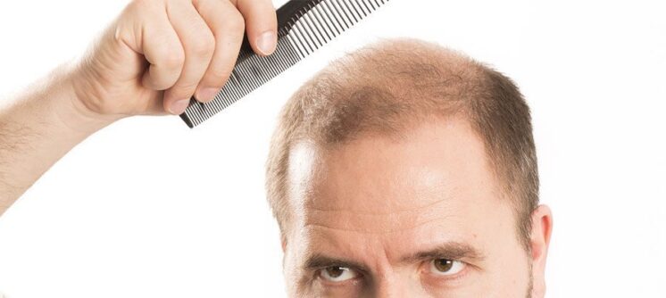 Genel Saç Yoğunluğu Artırma: Tüm Saçta Kalıcı Dolgunluk | Maya Hair Hospital